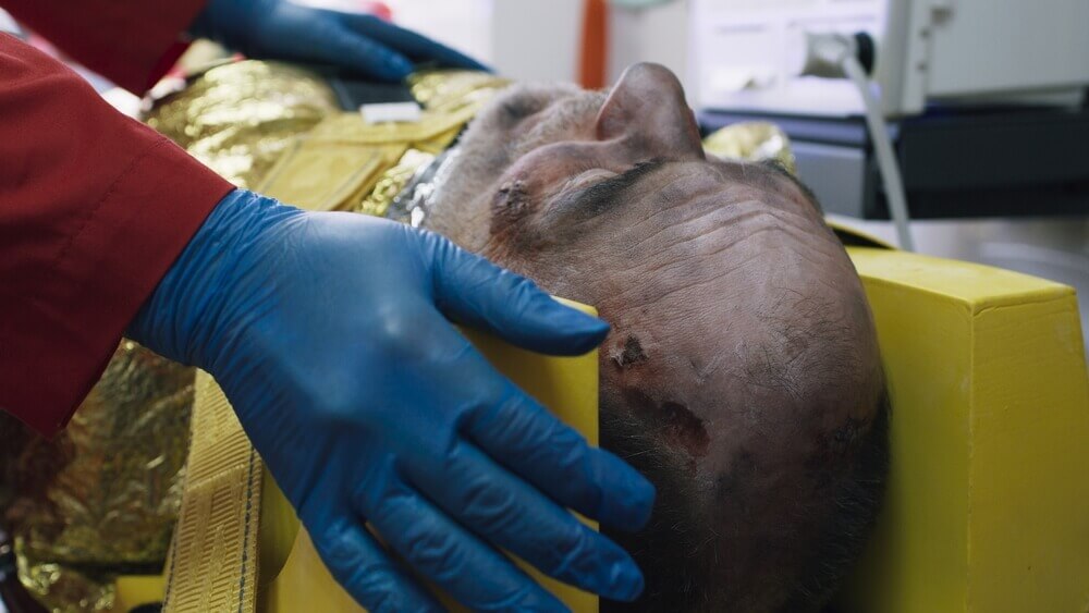 catastrophic injury litigation